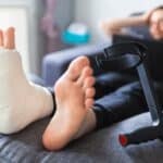 Cycling With A Broken Metatarsal – What You Should Know?