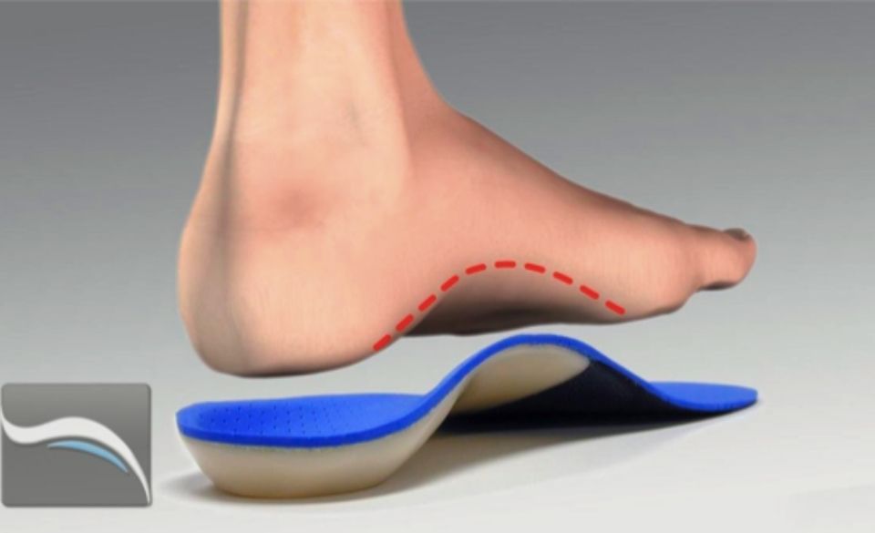What are insoles?