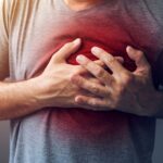 Heartburn and Acid Reflux After Running – Causes & Prevention