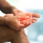 How To Treat Sore Feet After Running