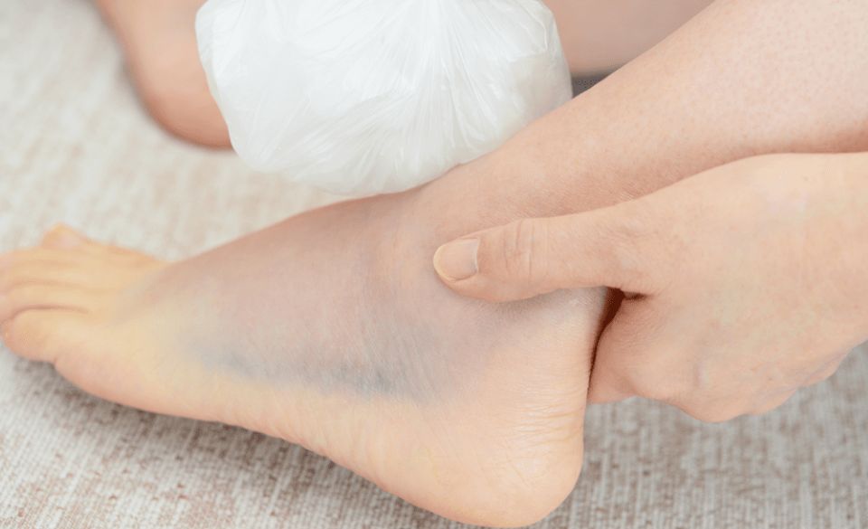 When To Start Running After A Sprained Ankle