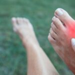 Running With Bunions – The Complete Guide To Treatment & Prevention