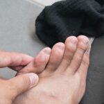 Preventing and Treating Blisters from Running