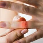 What Causes Finger Pain After Running