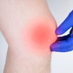 Can You Run with a Torn Meniscus? A Comprehensive Guide